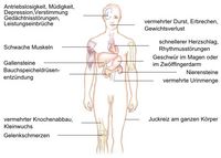 Beschwerden bei einer Überfunktion der Nebenschilddrüsen, Symptome bei einer Überproduktion der Nebenschilddrüsen