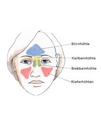 Kieferhöhlen, Siebbeinhöhle, Stirnhöhle, Keilbeinhöhle