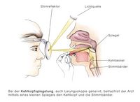 Kehlkopfspiegelung, Laryngoskopie bei Stimmbandknötchen