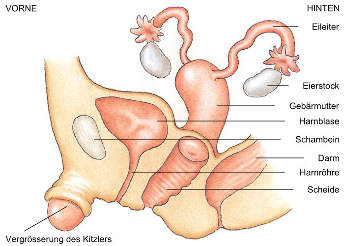 Darstellung der Vergrösserung des Kitzlers, der sogenannten Klitoris, bei e...
